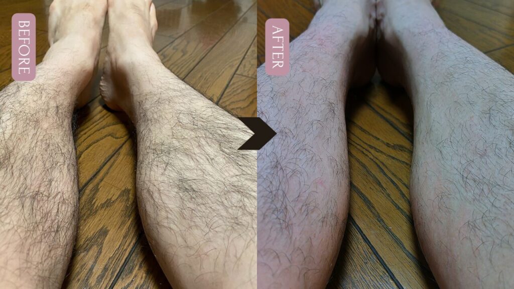 ケノンを使用した前と後の比較画像ビフォーアフターを撮影した写真